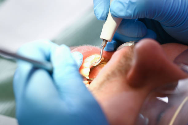 Best Emergency Dentist for Knocked-Out Tooth in Le Roy, IL