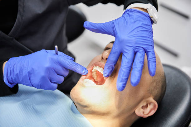 Best Emergency Dentist for Lost Fillings or Crowns in Le Roy, IL